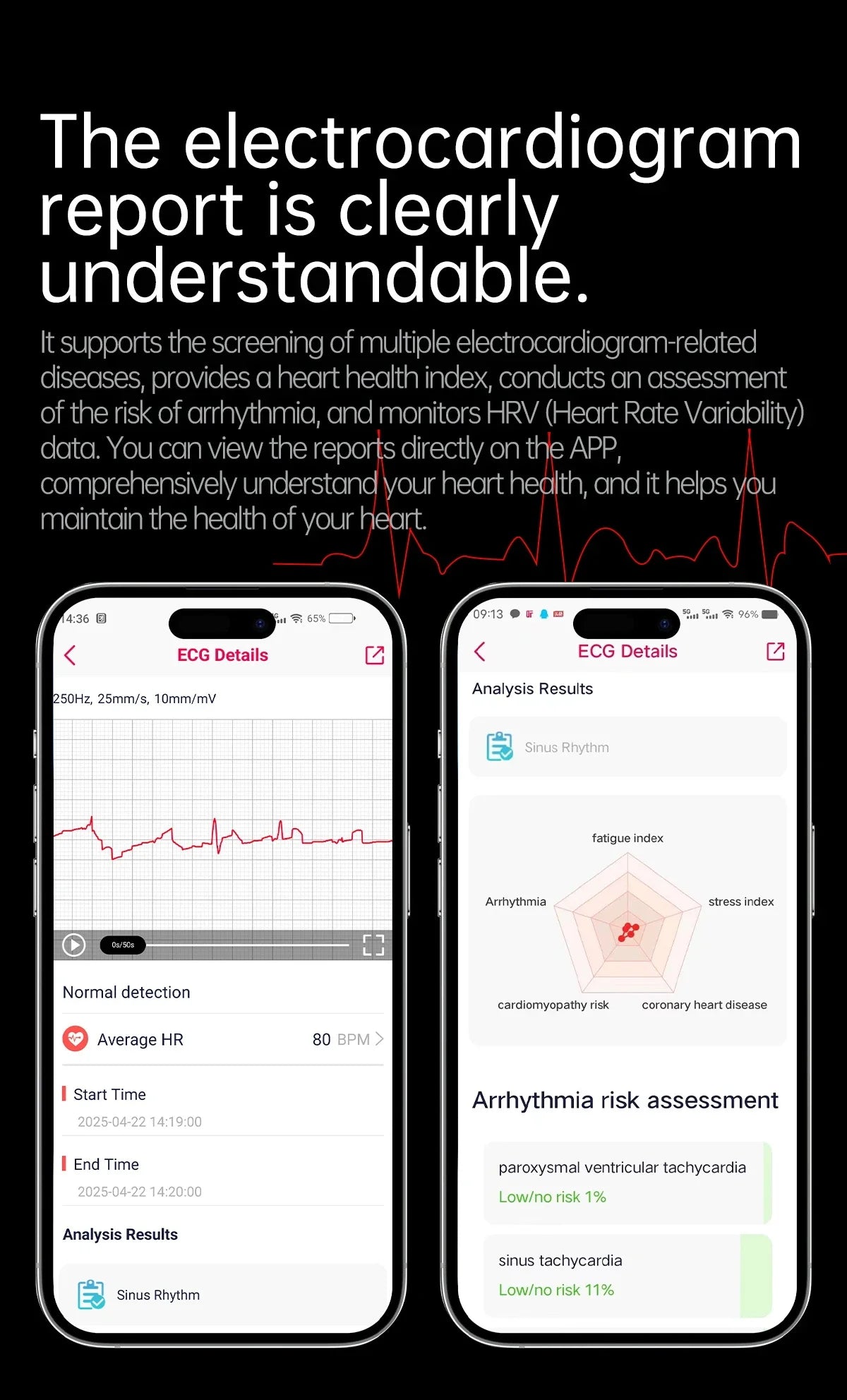 Smartwatch Saúde Avançada – Laser Inteligente, Diagnóstico Multinível e ECG+PPG