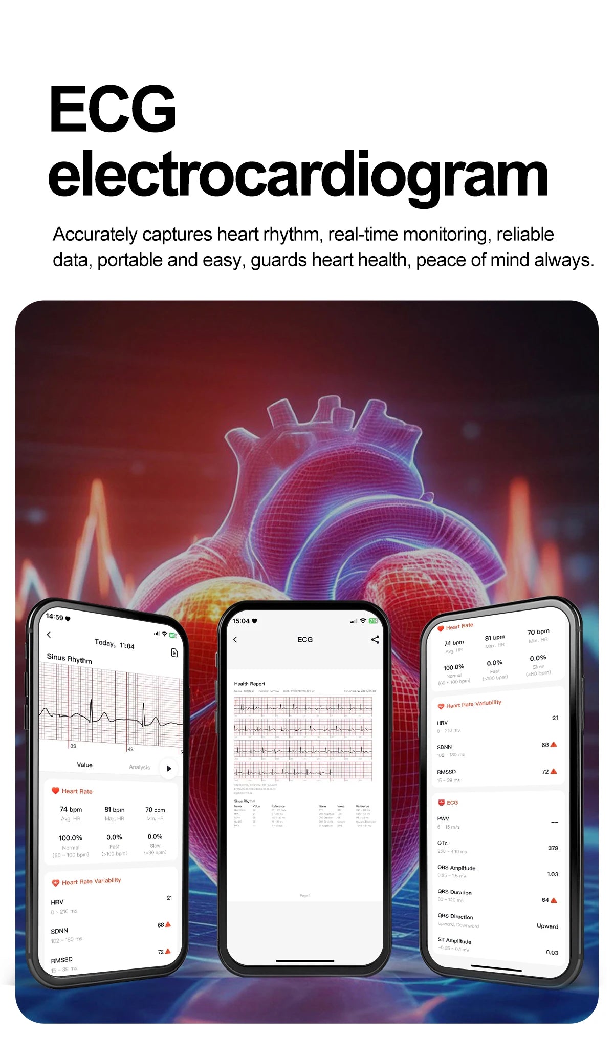 2026 New AI Health Care Accurate Detection ECG SmartWatch Blood Pressure Lipids Uric Acid Analysis Bluetooth Call Smart Watches